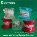Dental Model Dental Student Study Models Orthodontic Model